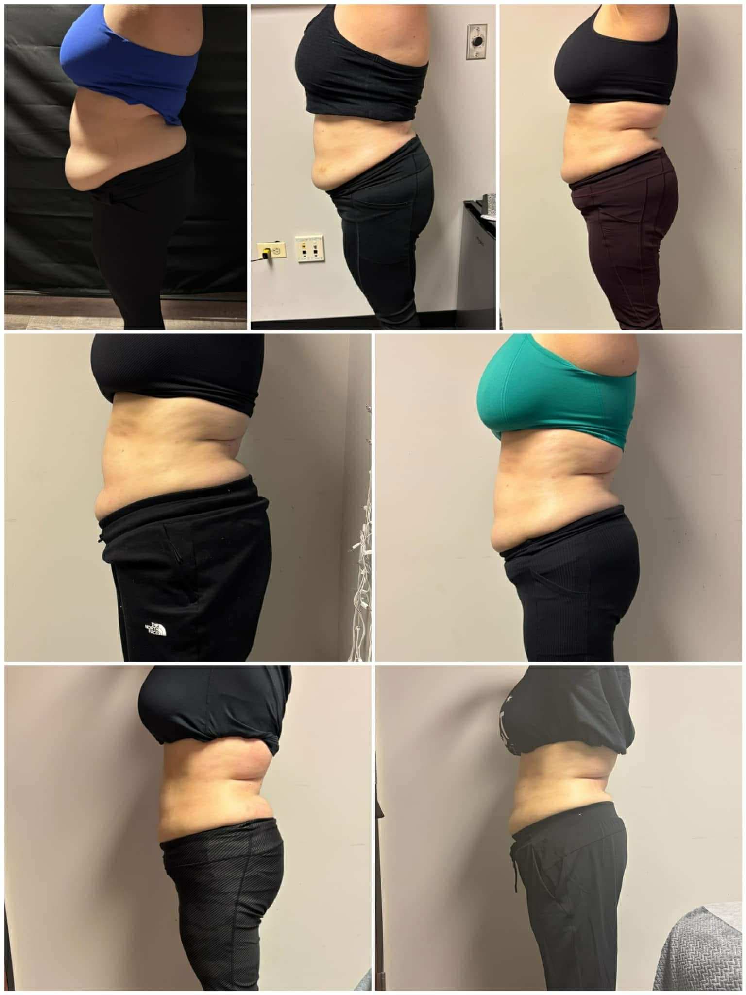 Treatment Results